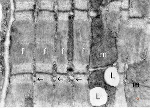 normal cardiomyocyte … longitudinal section(m … mitochondrion, f - myofilaments, L … lipid droplets, arrows … tubulesof sarcoplasmic reticulum) normal cardiomyocyte … longitudinal section(m … mitochondrion, f - myofilaments, L … lipid droplets, arrows … tubulesof sarcoplasmic reticulum)